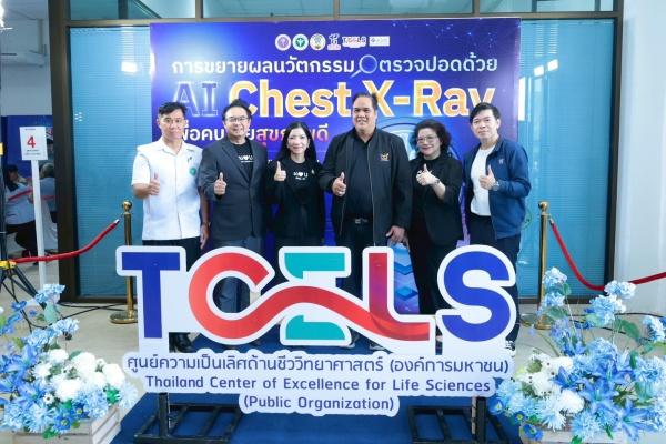 อว.ส่งAI X-Rayตรวจปอดฉับไวให้บริการฟรีถึงที่
